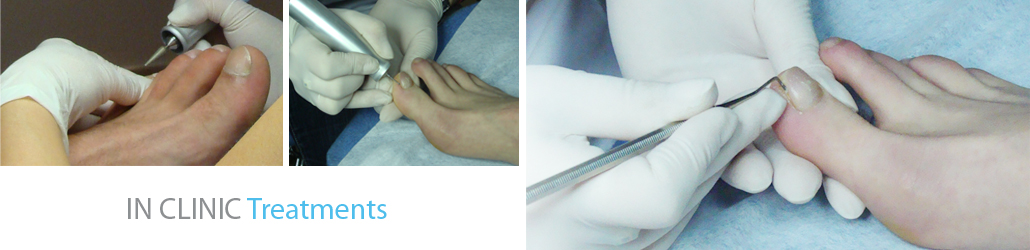 clinic foot care treatment